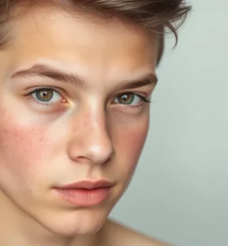 Un adolescente con acne